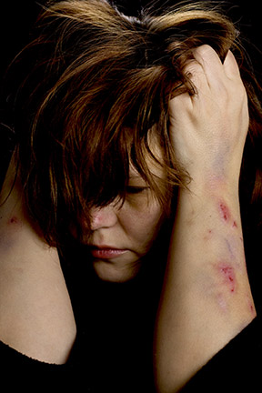 Dallas Divorce Attorneys 

can provide much-needed advice for cases 

involving domestic violence.